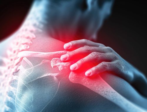 Shoulder Pain That Won’t Go Away? When to Consider Surgery