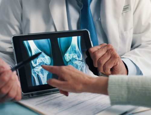 6 Signs It Might Be Time for a Hip or Knee Replacement